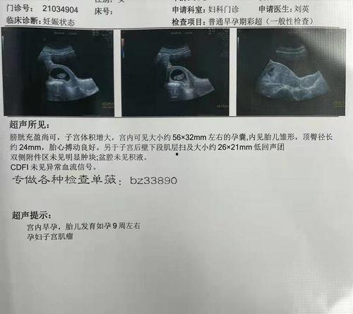 怀孕 照片,记录宝宝成长的美丽瞬间